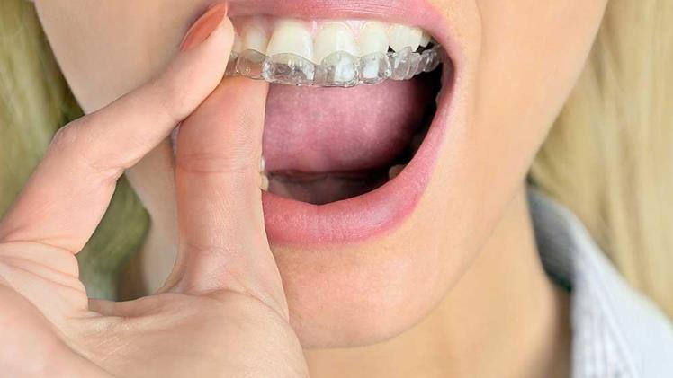 What Can I Use As a Temporary Mouth Guard?